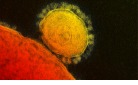 MERS virus.jpg