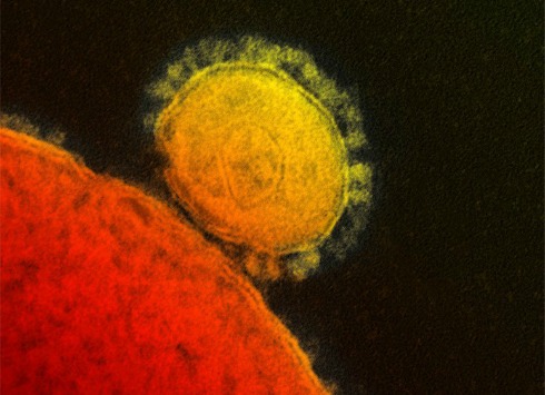 MERS virus.jpg