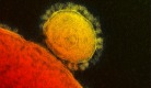 MERS virus.jpg
